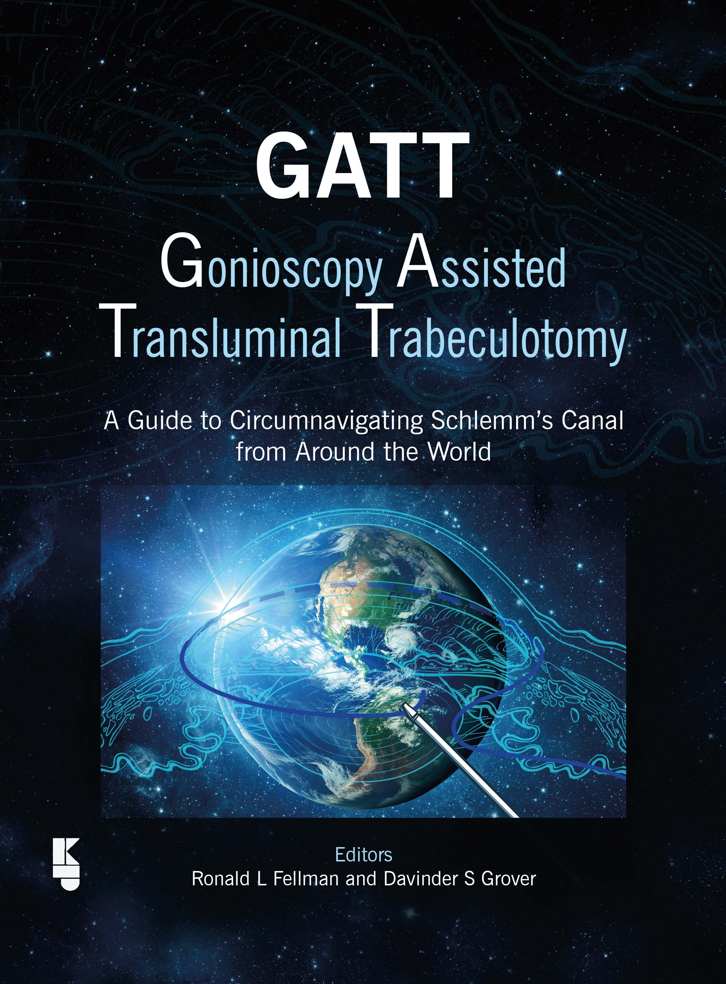 Book cover | GATT: Gonioscopy Assisted Transluminal Trabeculotomy